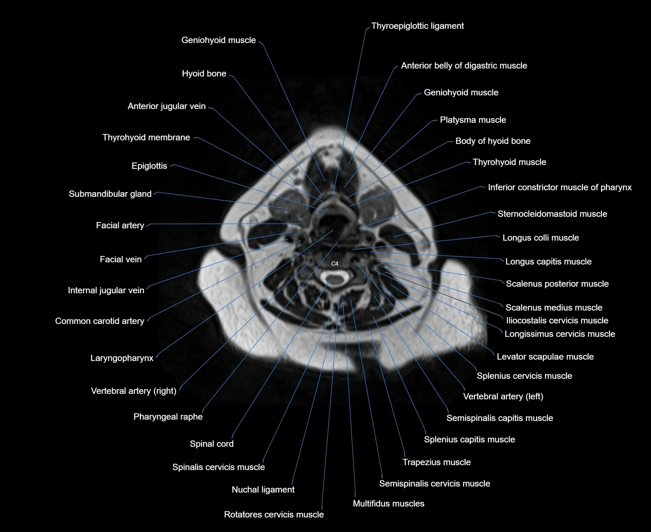 MRI Neck 3D labelled cross section anatomy axial 3t image-00001-00051.webp
